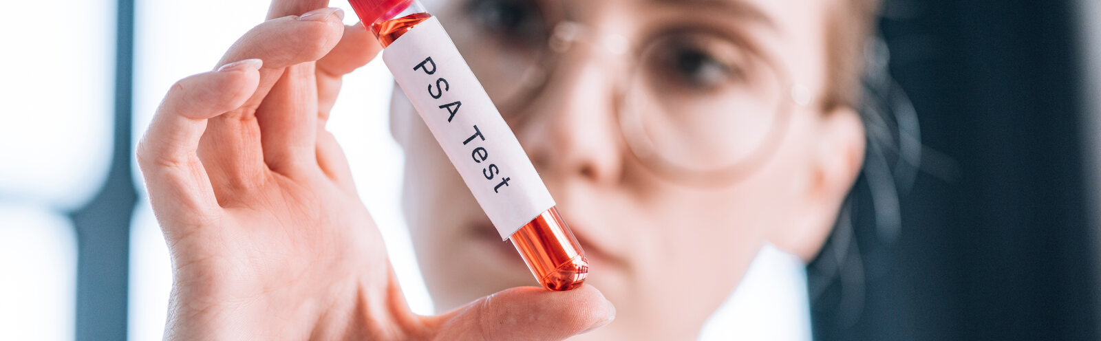 PSA Test Preparation
