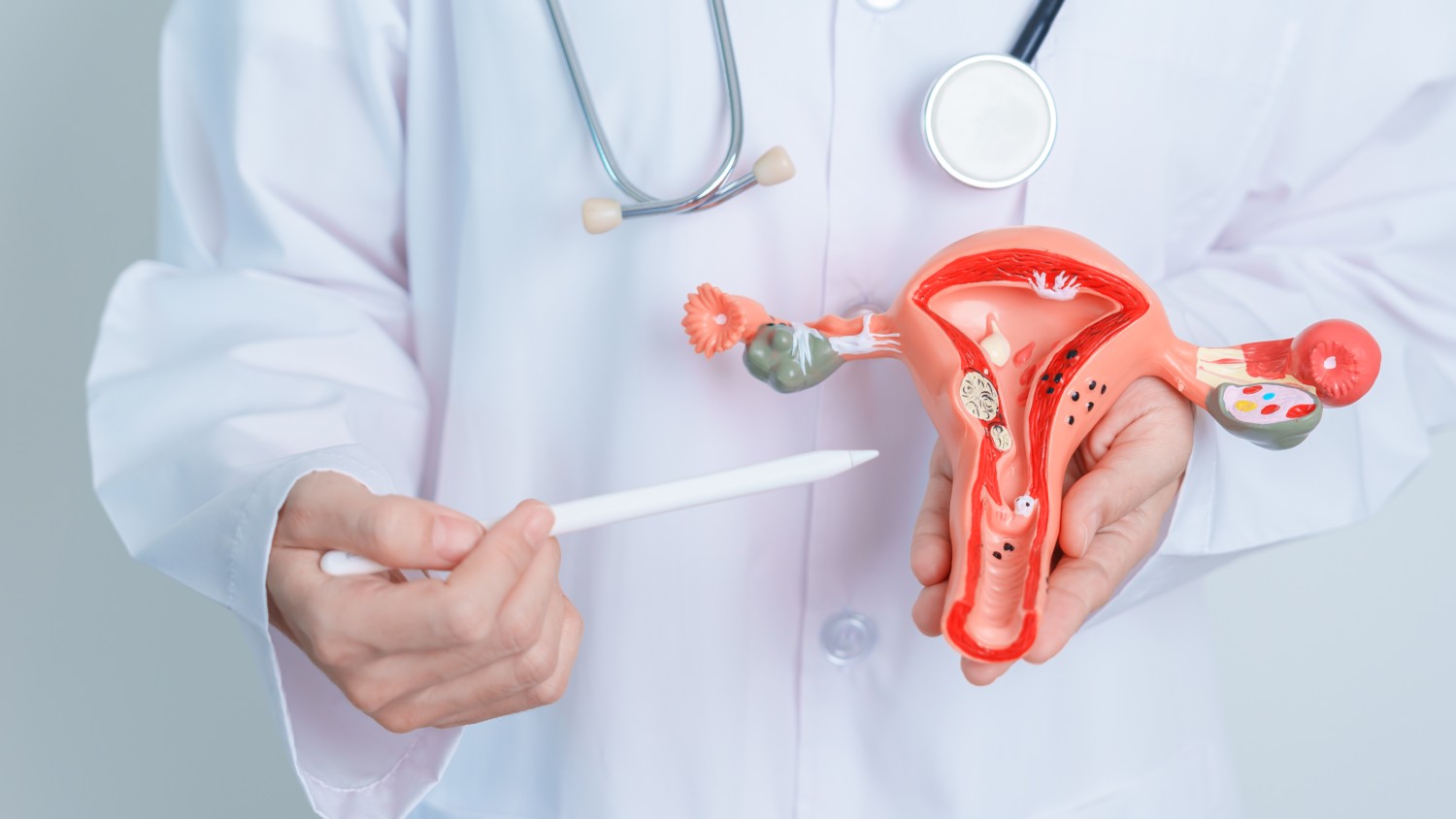 Prostate Artery Embolization